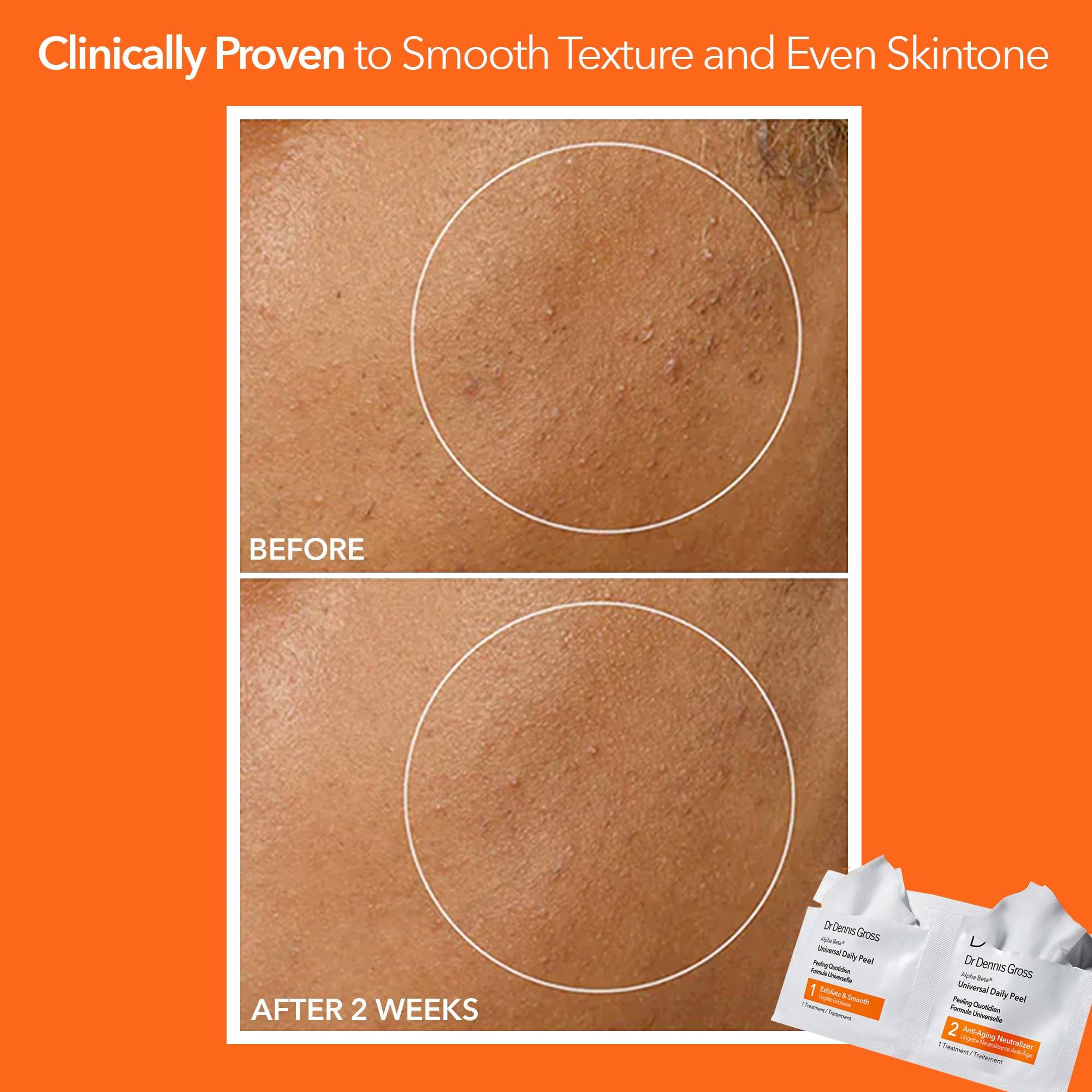 Authentic Dr Dennis Gross exfoliating pads for minimizing pores and smoothing fine lines.