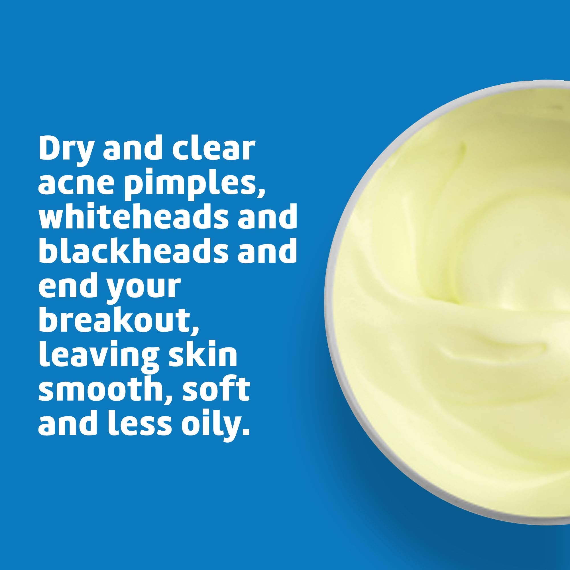 De La Cruz hormonal acne spot treatment cream container side view