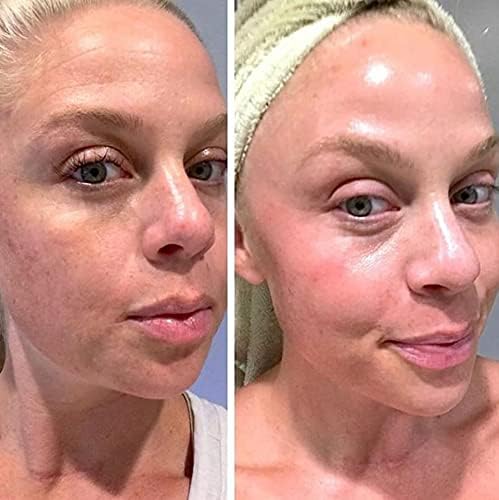 K6 Skin Care Vitamin A gel 20 grams packaging detail