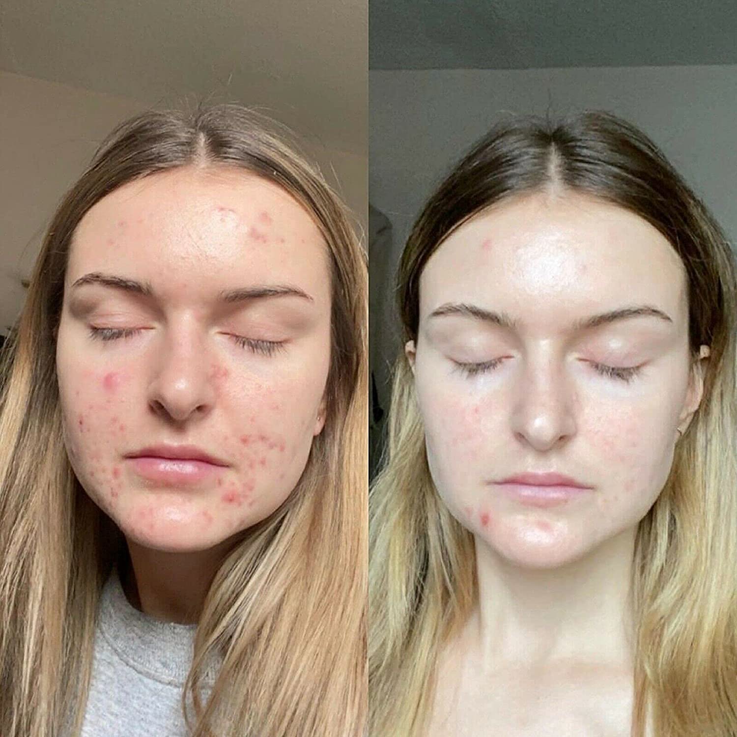 K6 Skin Care Retinol treatment gel for fine lines