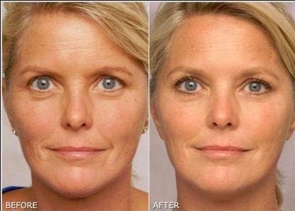 Authentic K6 Skin Care 0.1 percent retinol gel tube