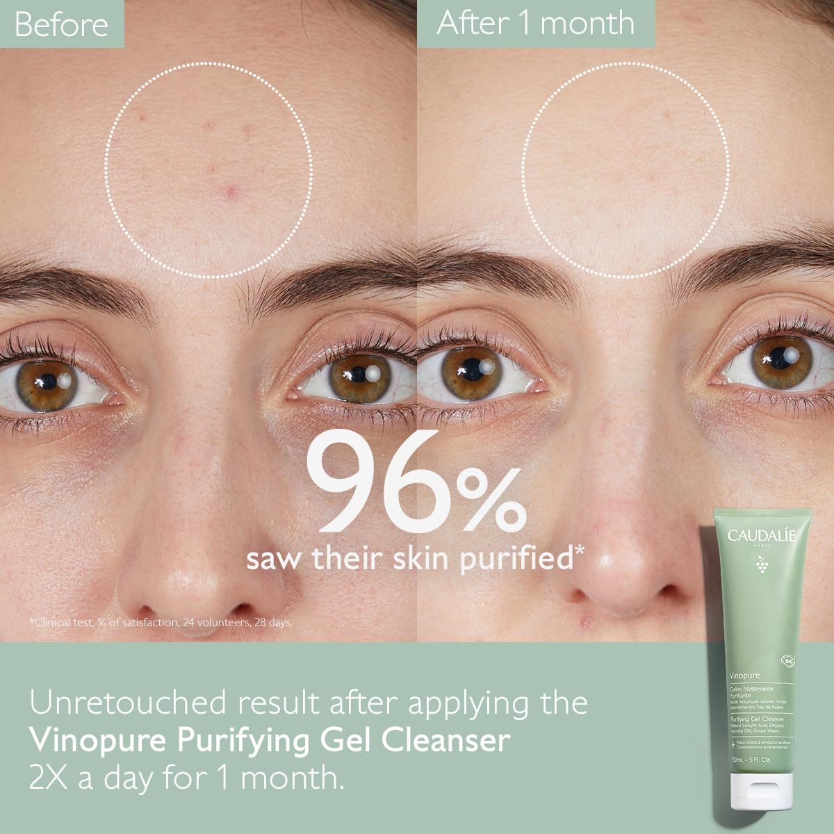 Caudalie gel cleanser for acne prone skin texture preview