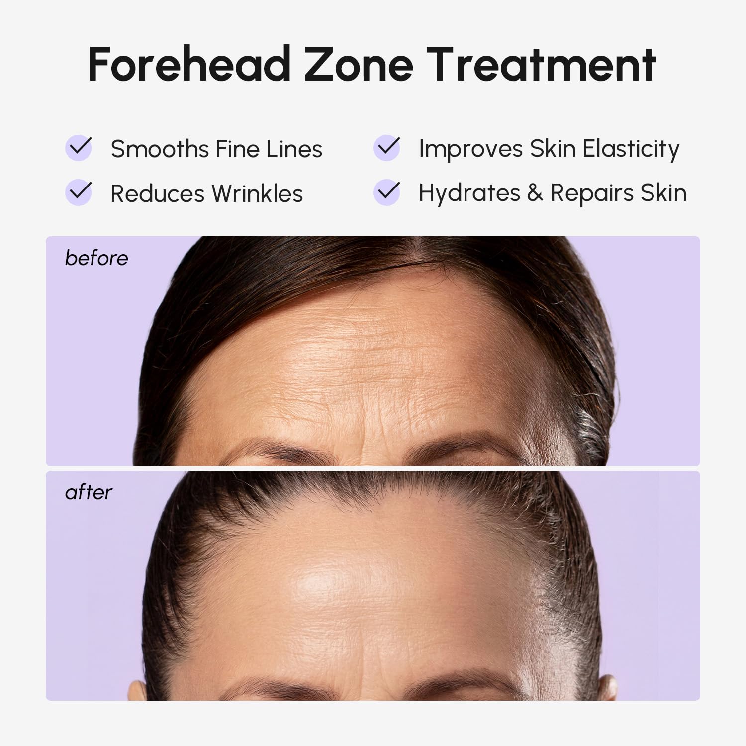 Maree collagen and retinol forehead patches for face lift