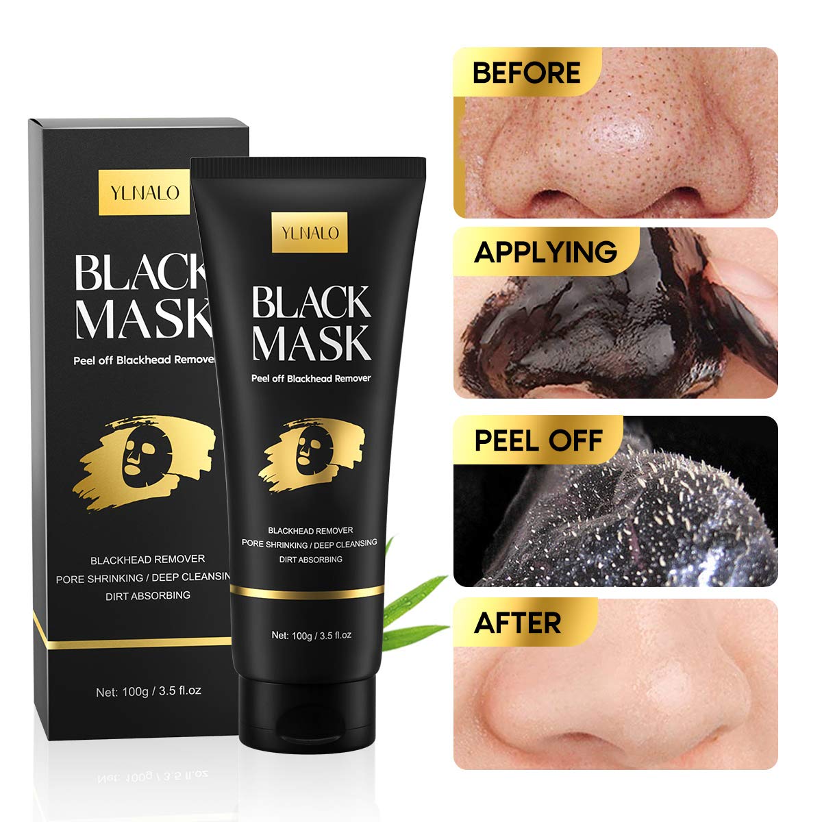 Stainless steel blackhead extractor tools included in Ylnalo kit