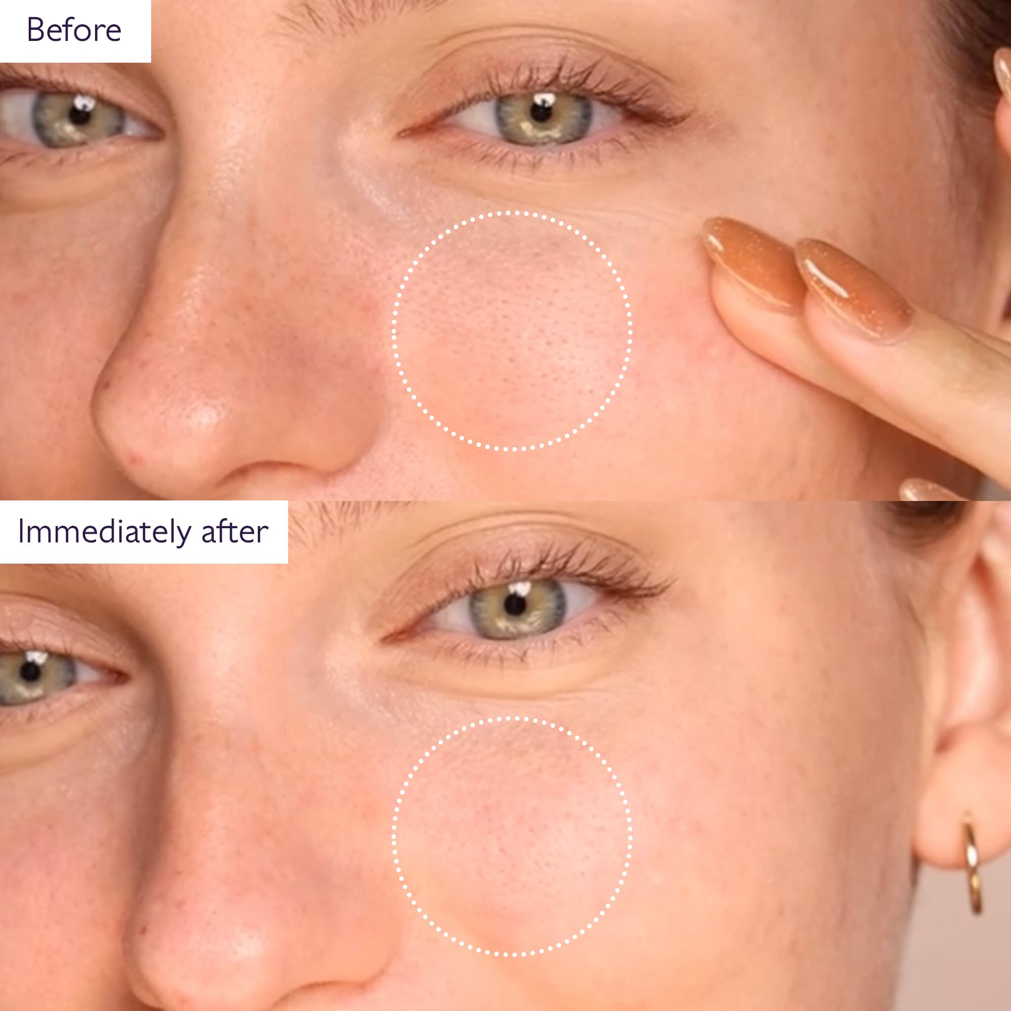 Caudalie detox mask applied on skin for pore cleaning