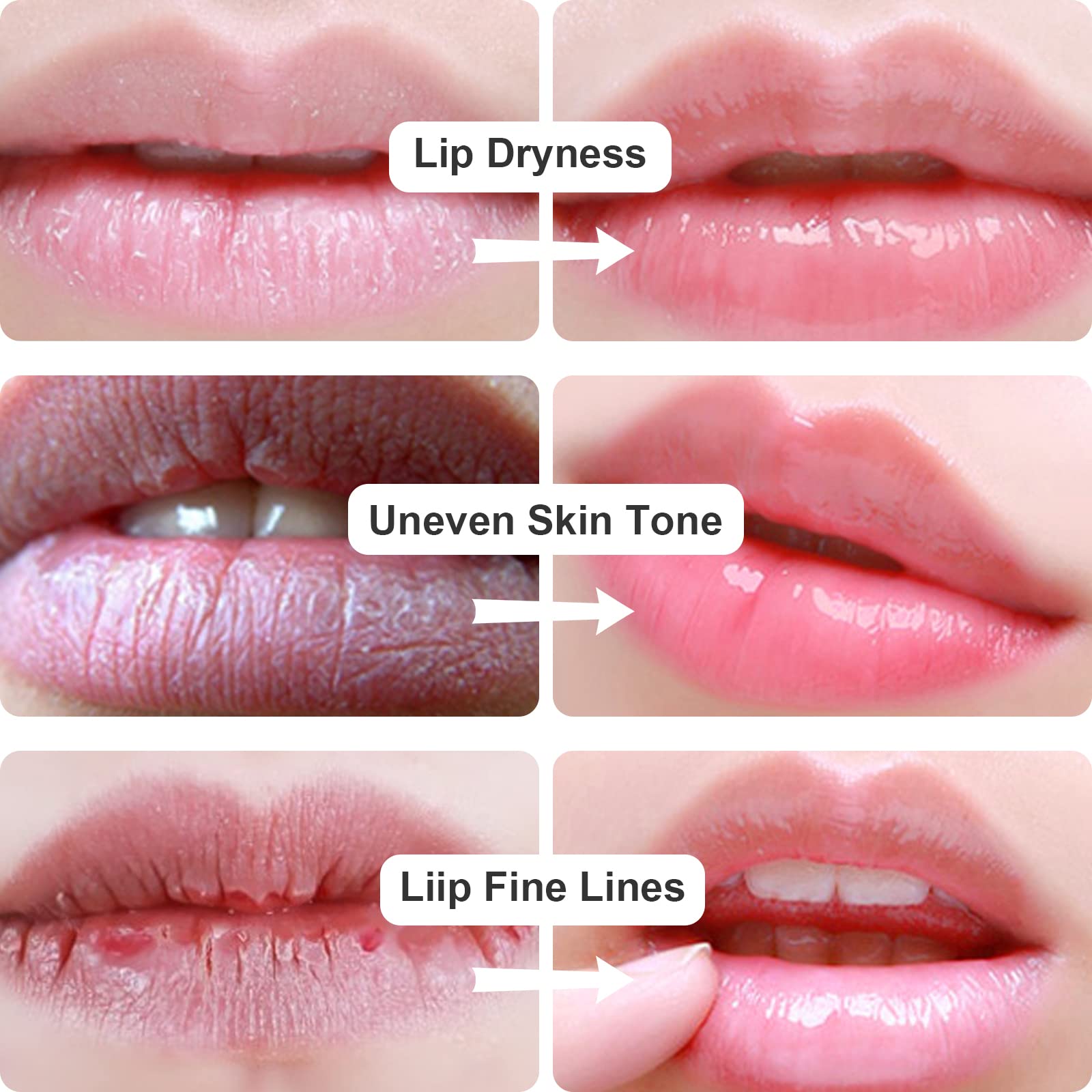 Individual sealed packets of Permotary lip care patches