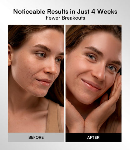 Inia rechargeable face mask packaging and accessories