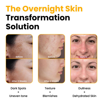 Texture of QUIA turmeric and kojic acid face mask