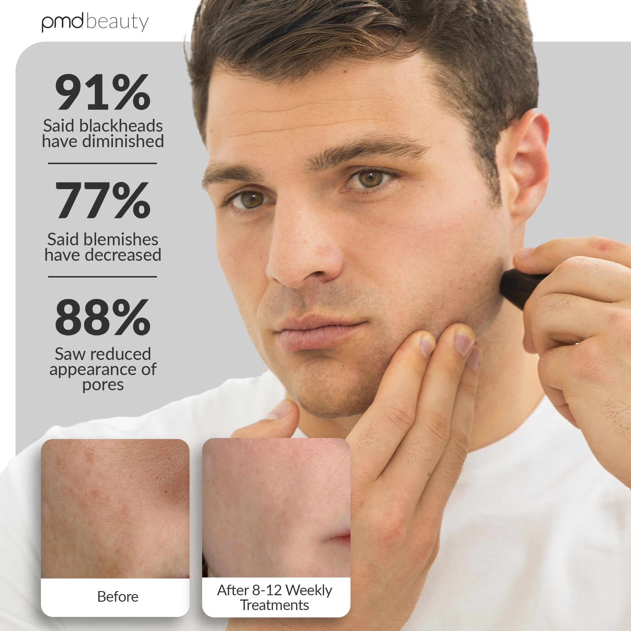 PMD Beauty microdermabrasion machine for men targeting face and body exfoliation