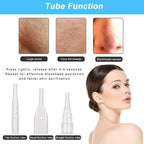 Diamond microdermabrasion system setup featuring spray bottles and tubing.