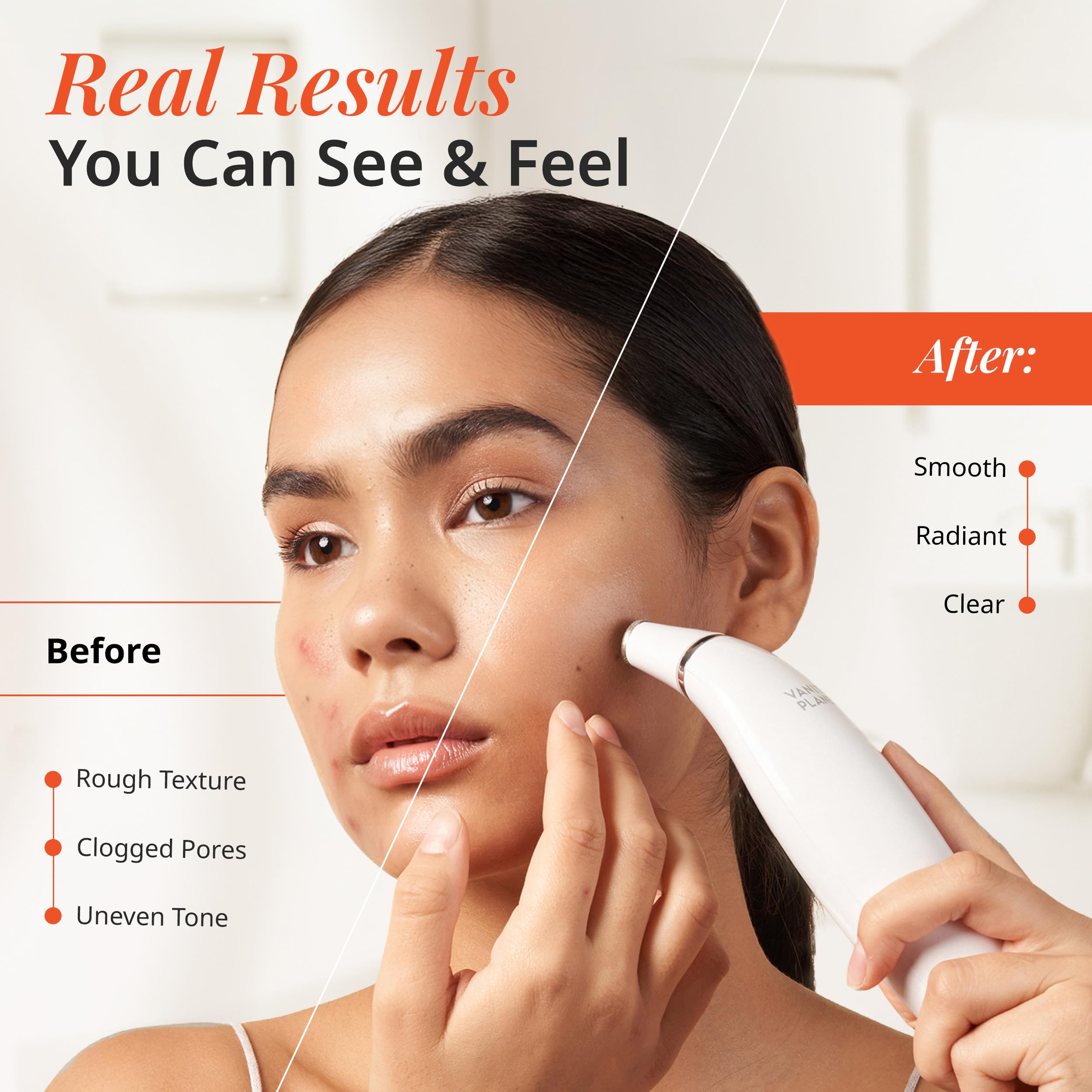 Vanity Planet Exfora facial cleanser wand showing medical-grade diamond tips