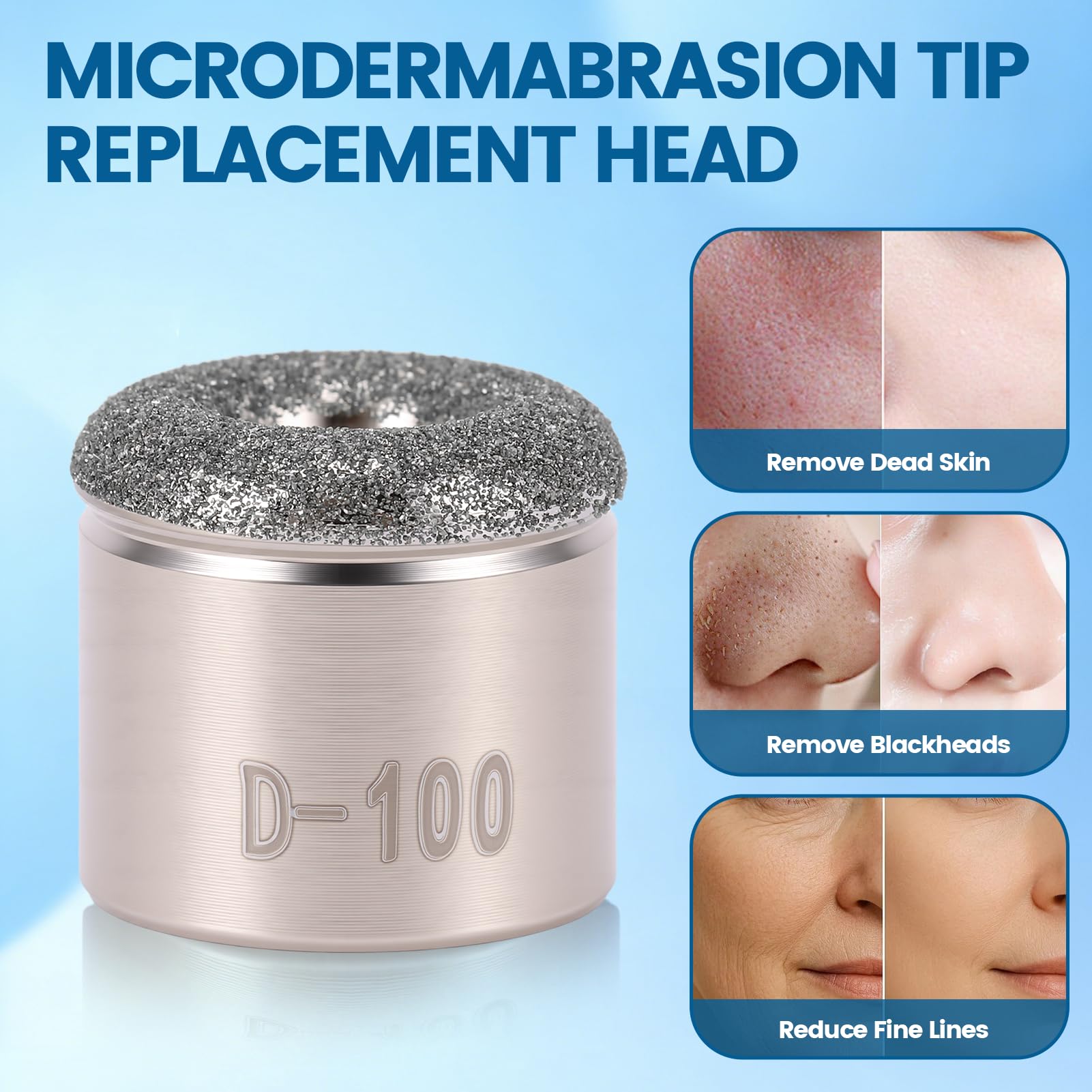 RANNYY fine tip skin exfoliating accessory for blackhead vacuum and dermabrasion machine