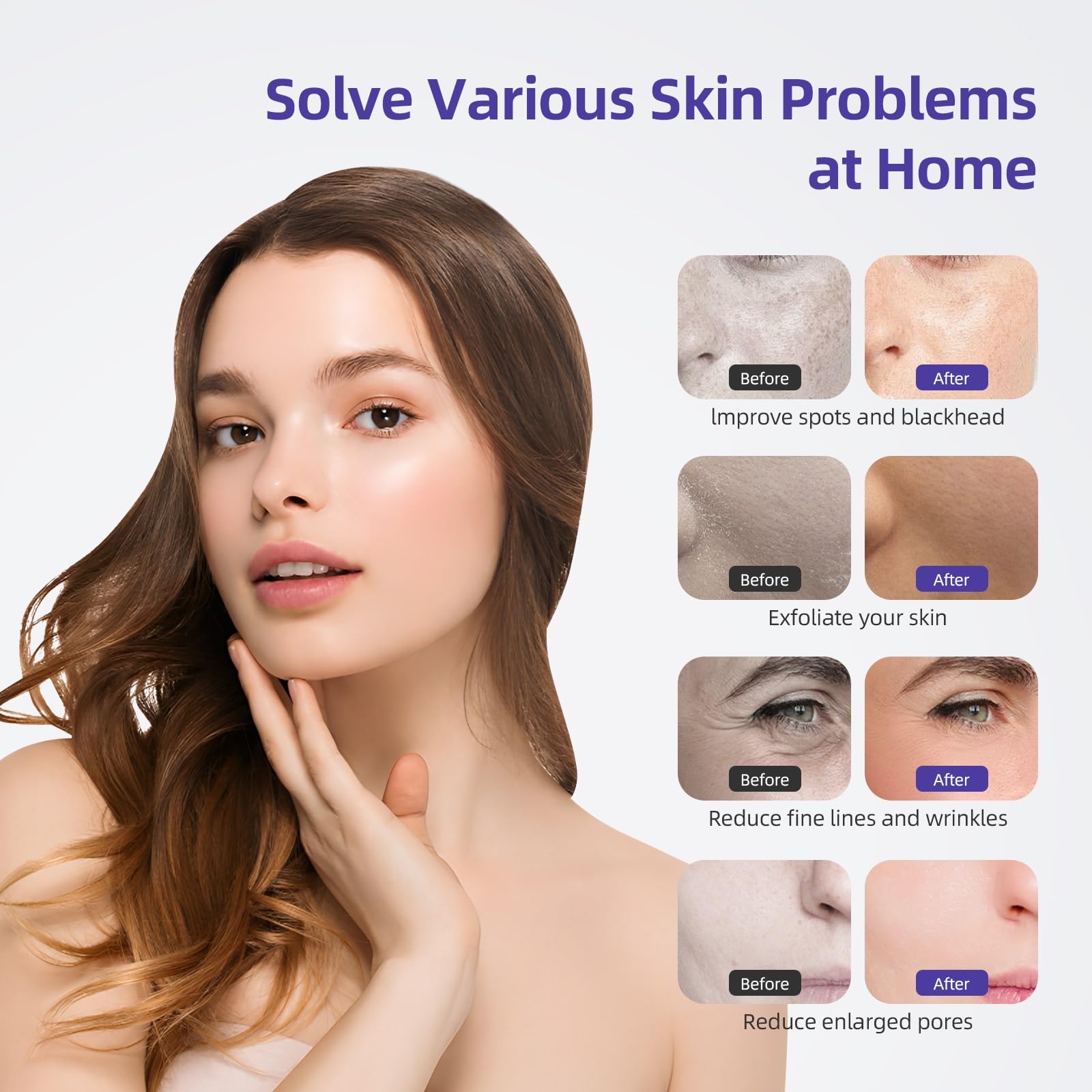 Three in one facial dermabrasion device with vacuum wands and spray bottles