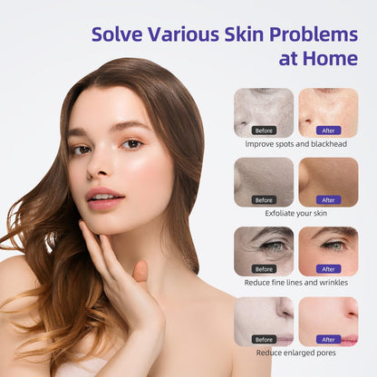 Three in one facial dermabrasion device with vacuum wands and spray bottles