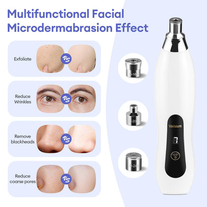 IeBilif professional microdermabrasion device with interchangeable diamond tips.
