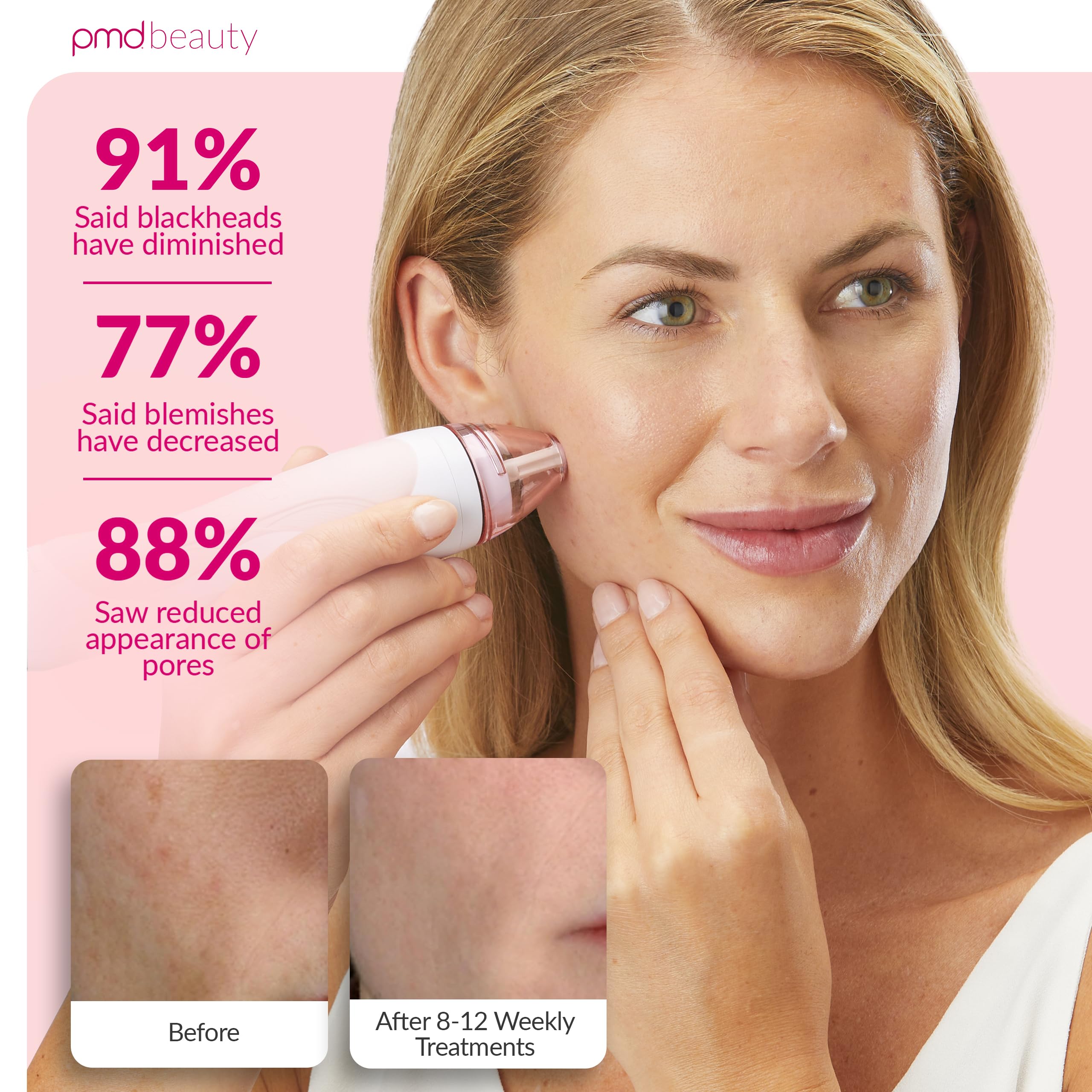 PMD Beauty Personal Microderm Pro kit with power adapter and accessories