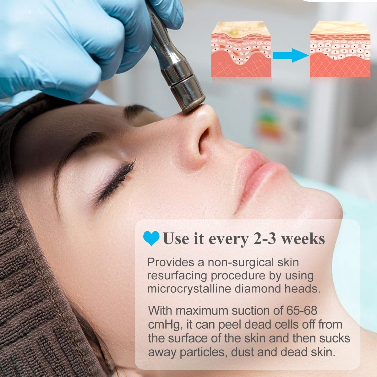 Close-up view of the Mcwdoit professional beauty device highlighting the adjustable suction control knob and internal filter system.
