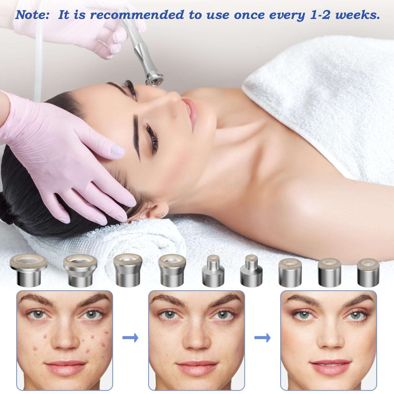 4beauty Therapy microdermabrasion components organized neatly to showcase the variety of tools included for salon-grade skin rejuvenation.