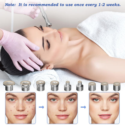 4beauty Therapy microdermabrasion components organized neatly to showcase the variety of tools included for salon-grade skin rejuvenation.