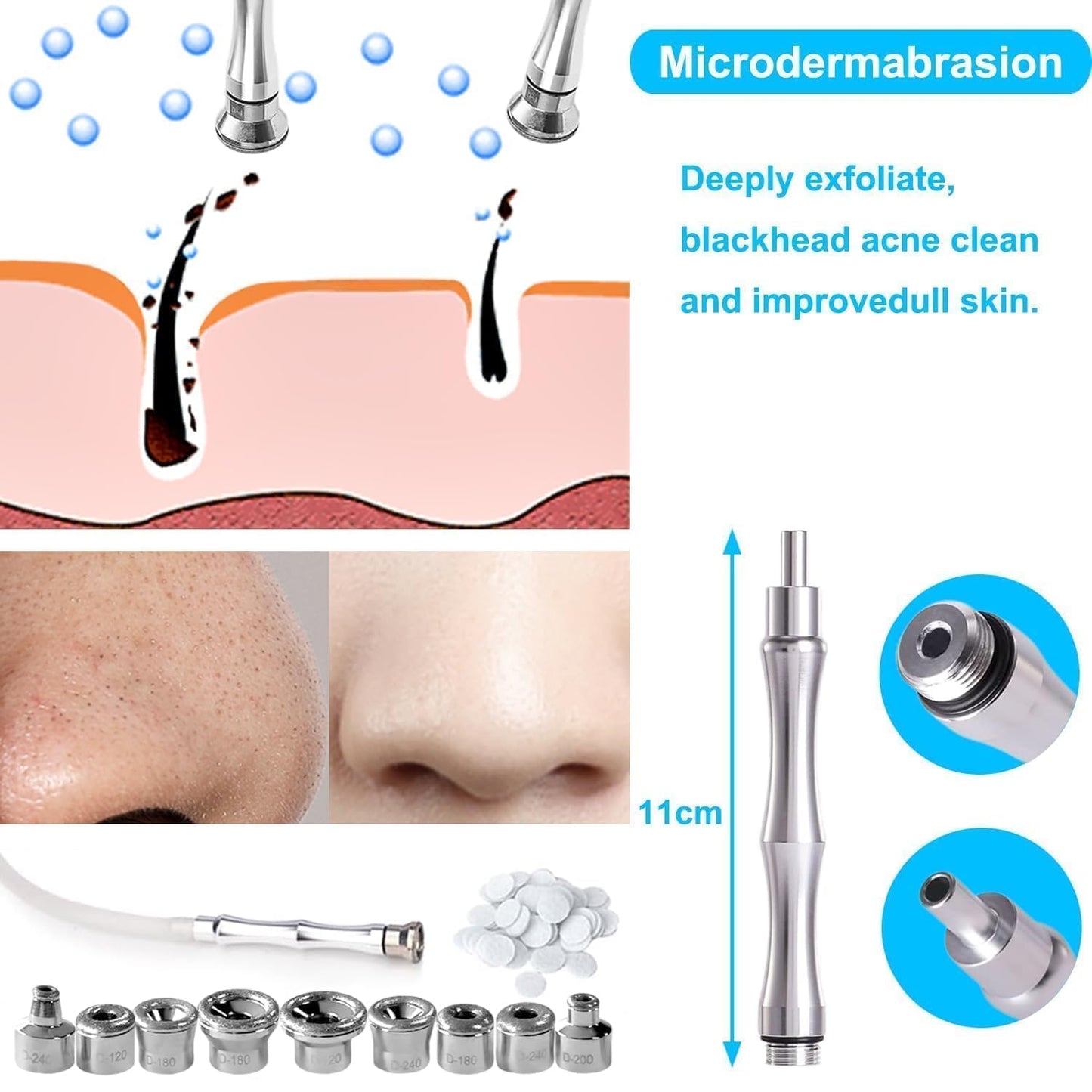 ZEIZOMZER diamond tip kit components organized for home facial exfoliation.