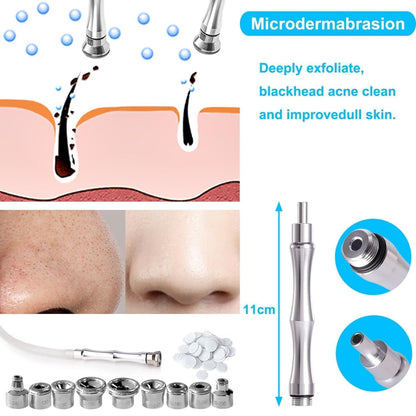 ZEIZOMZER diamond tip kit components organized for home facial exfoliation.