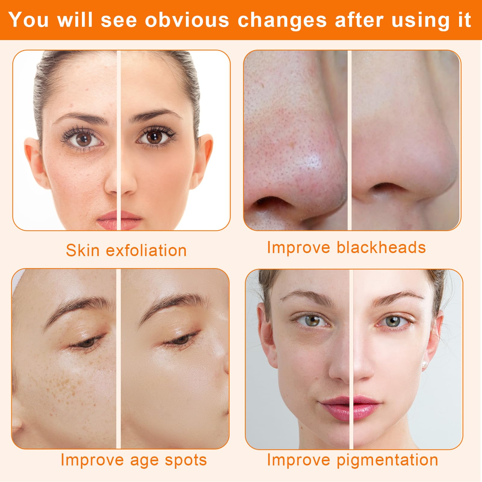 Mcwdoit microdermabrasion system showcasing the spray bottle attachment for post-treatment skin hydration.
