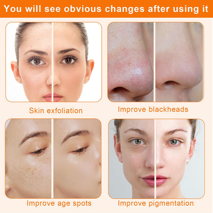 Mcwdoit microdermabrasion system showcasing the spray bottle attachment for post-treatment skin hydration.