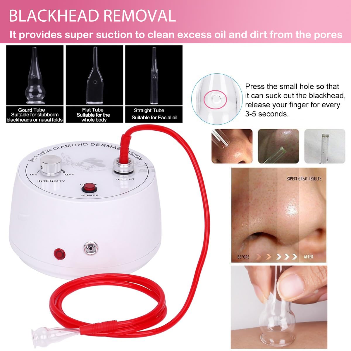 At home microdermabrasion kit including nine interchangeable diamond tips for customizable exfoliation.