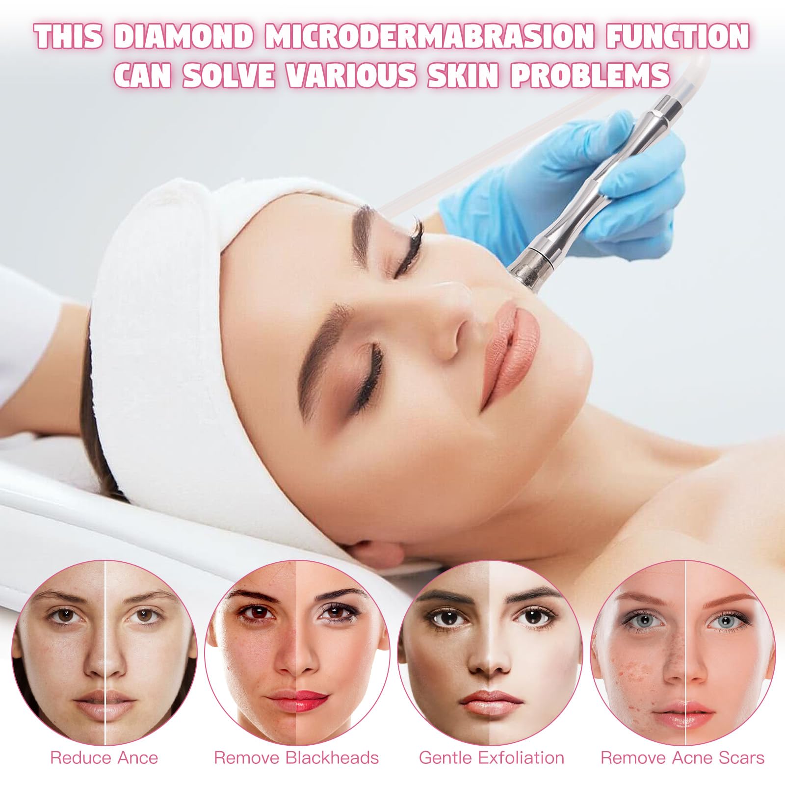Close up view of the intensity adjustment controls on the portable diamond dermabrasion unit.