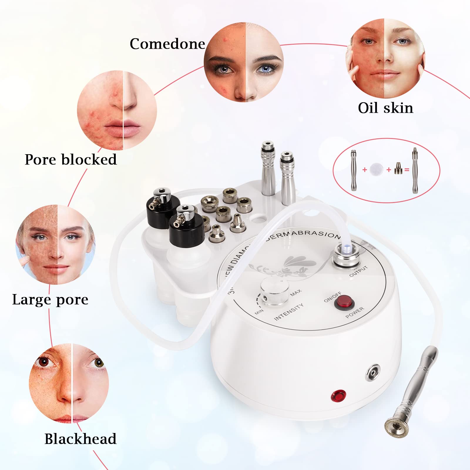 AIMENGXI diamond dermabrasion kit displaying interchangeable sterile diamond heads and steel wands for targeted facial therapy