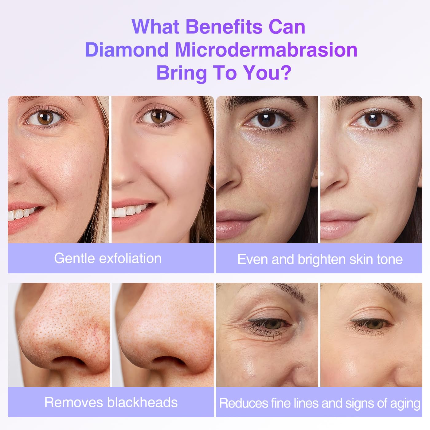 Universal compatibility demonstration of UNOISETION diamond tip replacements for skincare machines.