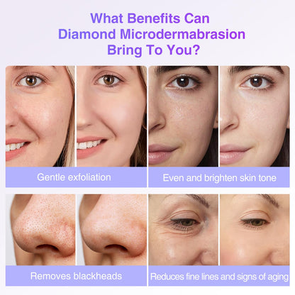 Universal compatibility demonstration of UNOISETION diamond tip replacements for skincare machines.