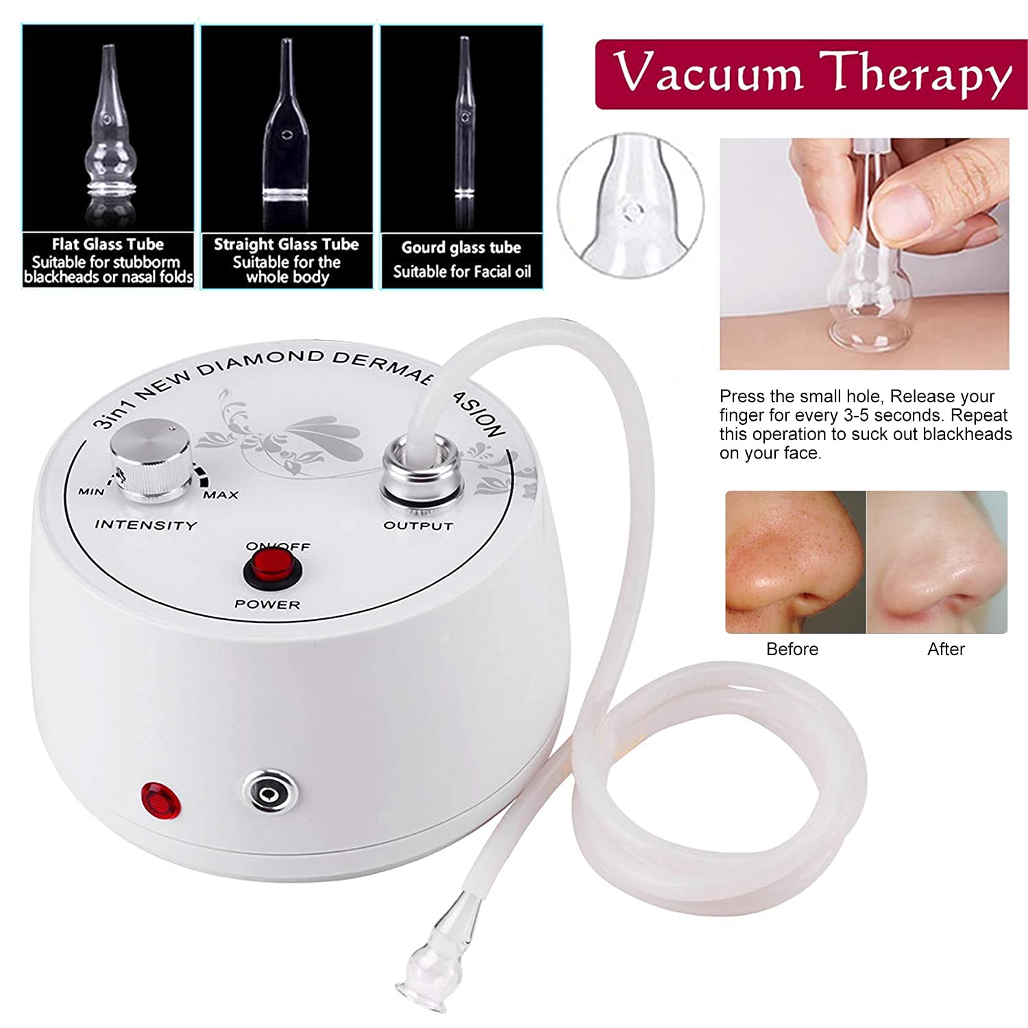 Close up of the sterile diamond exfoliation heads included with the Yofuly beauty machine