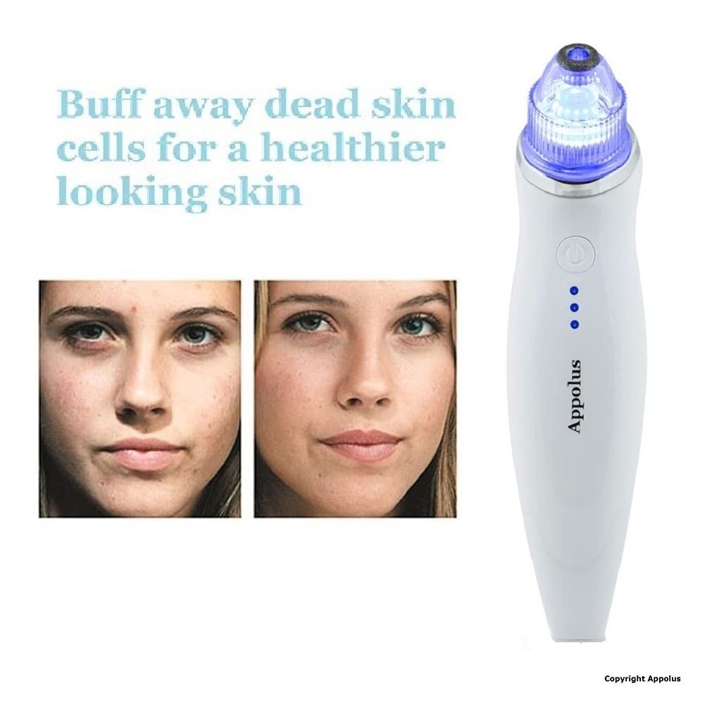 At home microdermabrasion device with diamond exfoliation tips