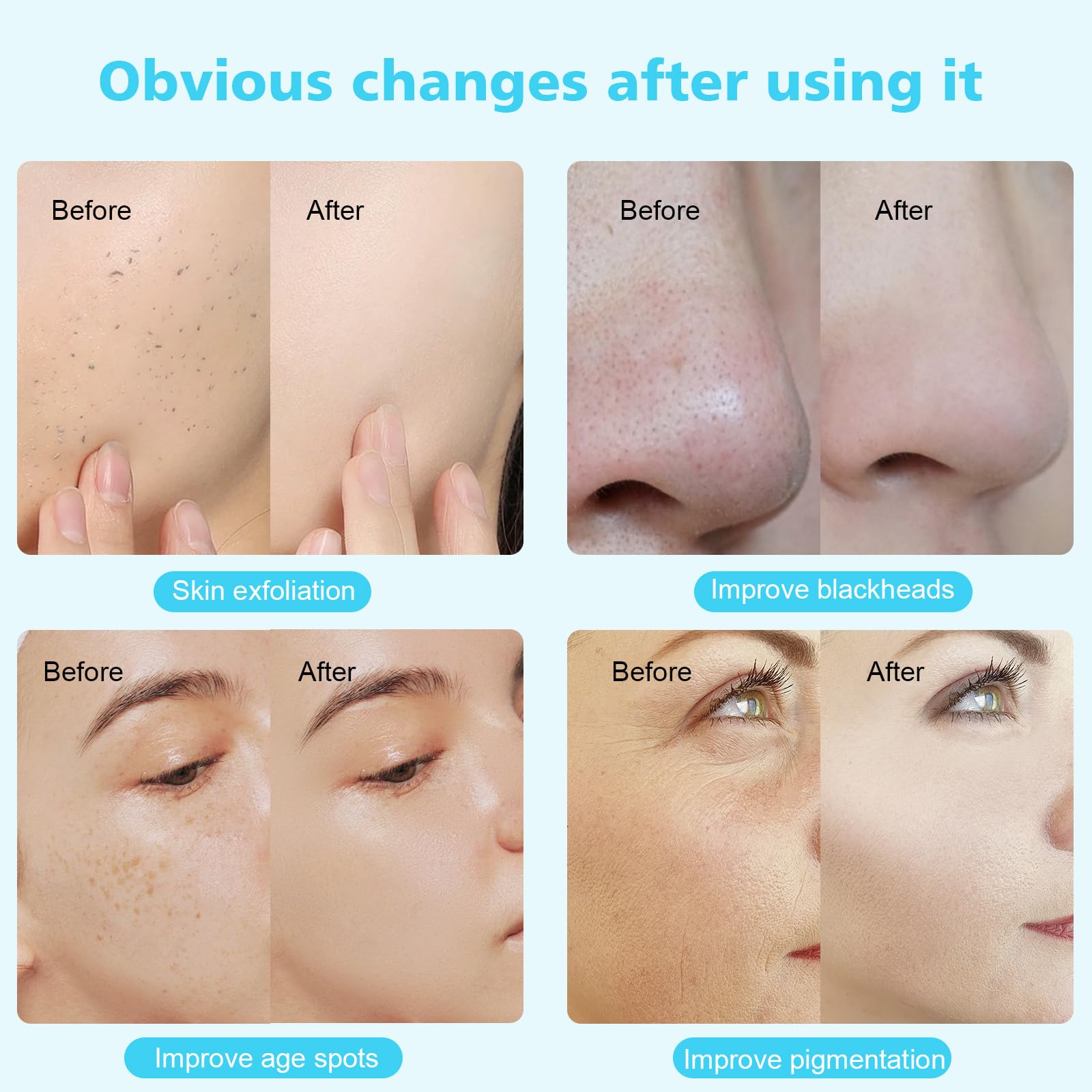 Aesthetic lifestyle setup of the Mcwdoit professional skin care machine for home salon use.