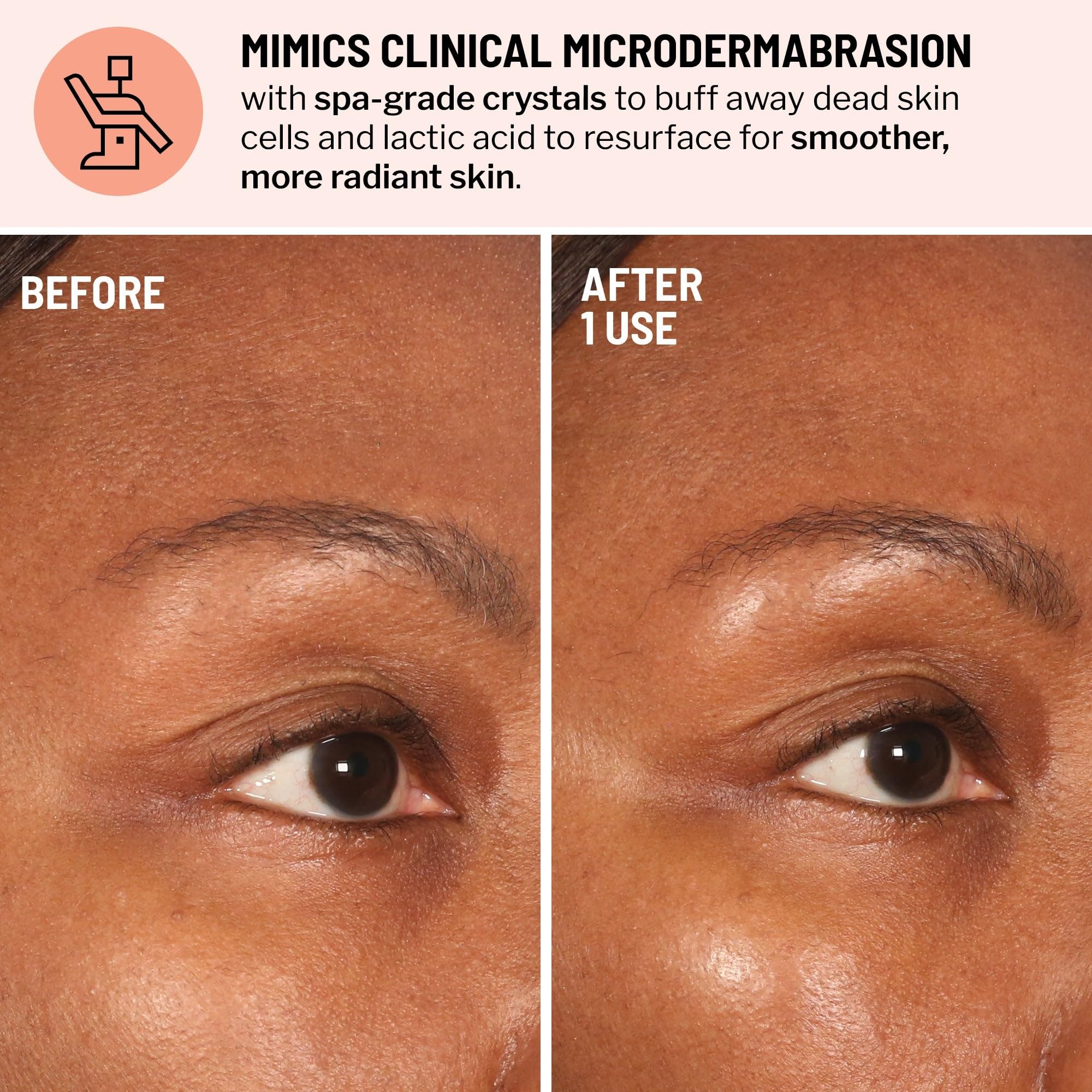 Dr. Brandt Skincare at-home microdermabrasion cream bottle showing product details and net weight