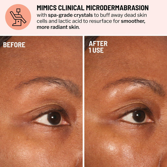 Dr. Brandt Skincare at-home microdermabrasion cream bottle showing product details and net weight