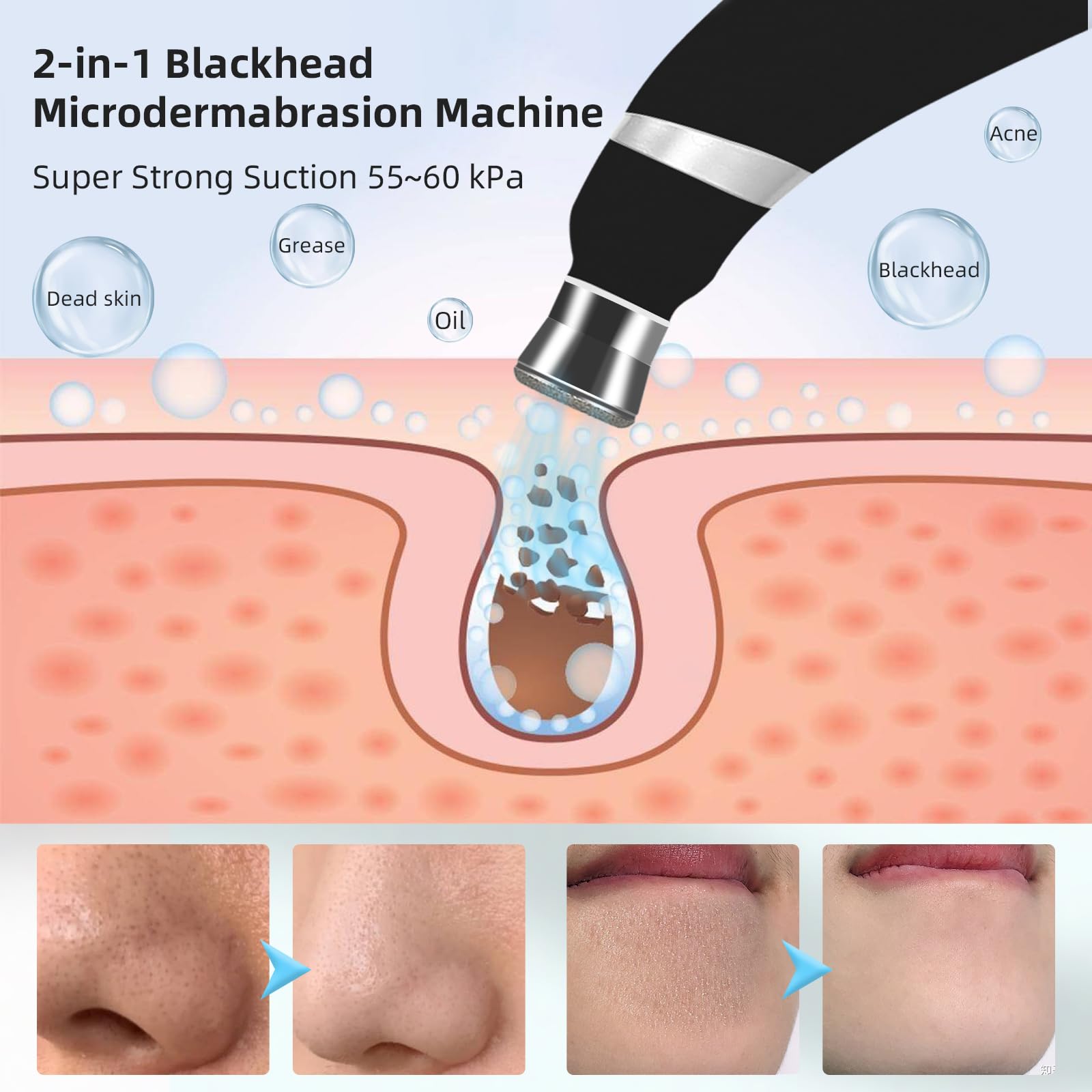Close up of the adjustable suction modes interface on the facial cleaning device