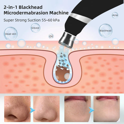 Close up of the adjustable suction modes interface on the facial cleaning device