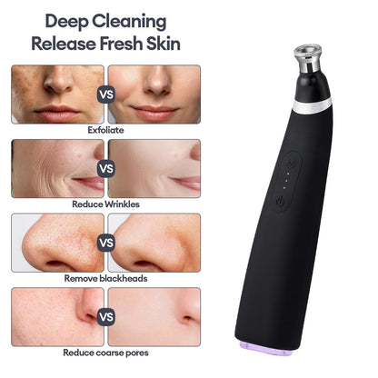 Full contents of the imported microdermabrasion kit including filters and USB cable