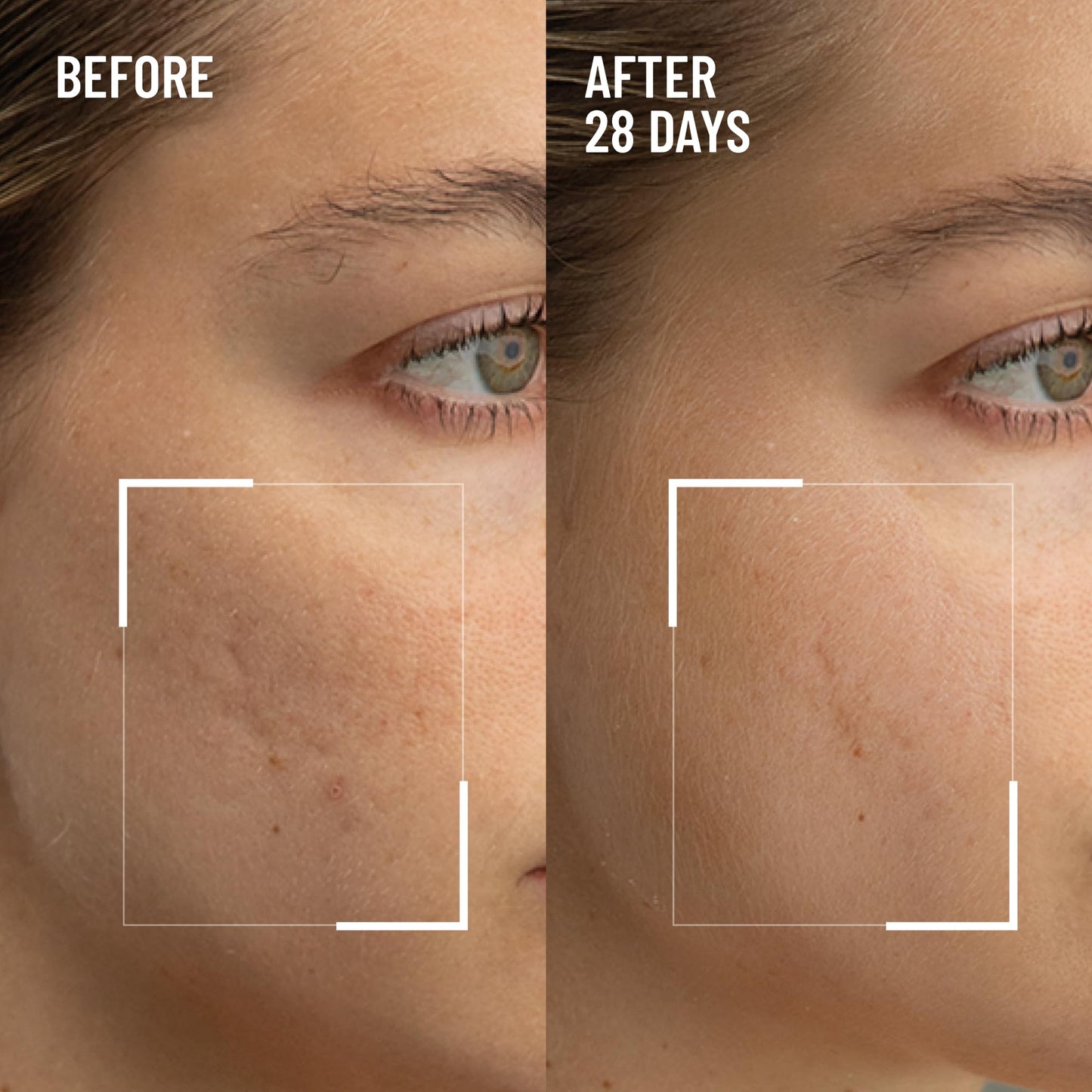 Dr. Brandt Skincare professional dual action facial scrub packaging texture shot