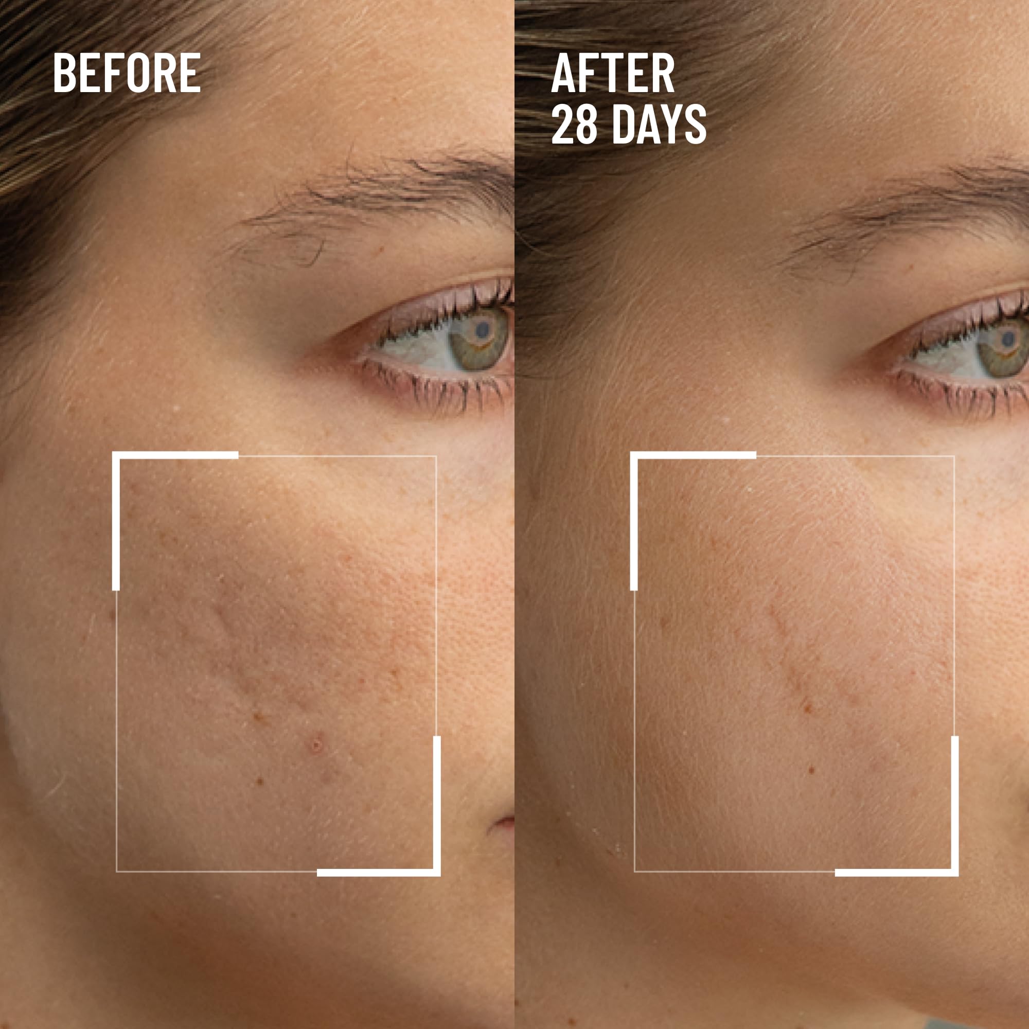 Dr. Brandt Skincare professional dual action facial scrub packaging texture shot