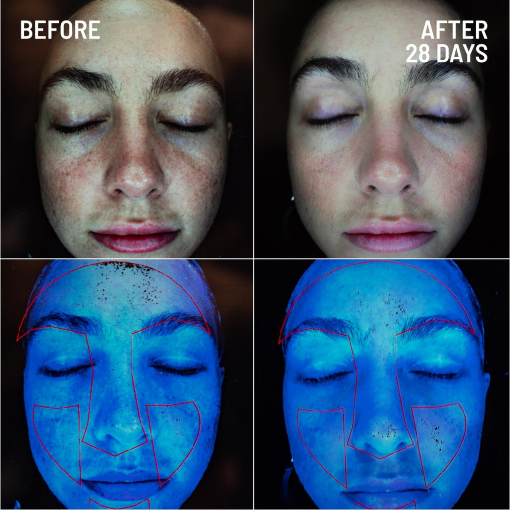Dr. Brandt Skincare Microdermabrasion Renewing Face Exfoliator side angle display