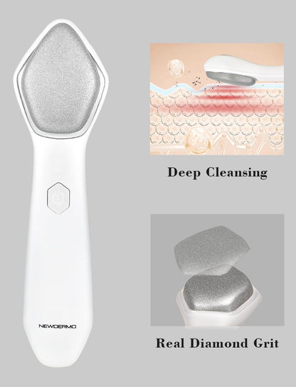 Ergonomic white skin exfoliation wand displaying the complete cordless design setup.