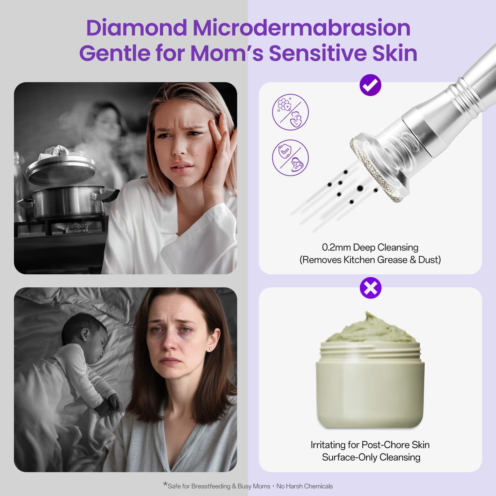 UNOISETION professional microdermabrasion kit showing 9 sterile diamond tips and 3 wands