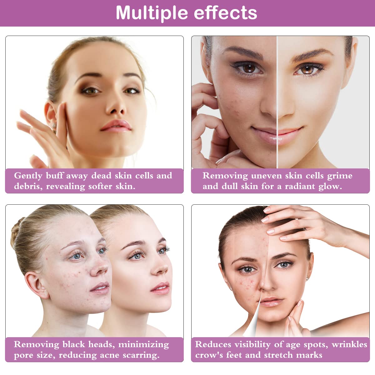 The complete packaging of Yofuly home use facial equipment detailing the premium accessories and filtration parts.