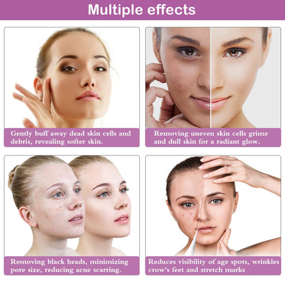 The complete packaging of Yofuly home use facial equipment detailing the premium accessories and filtration parts.