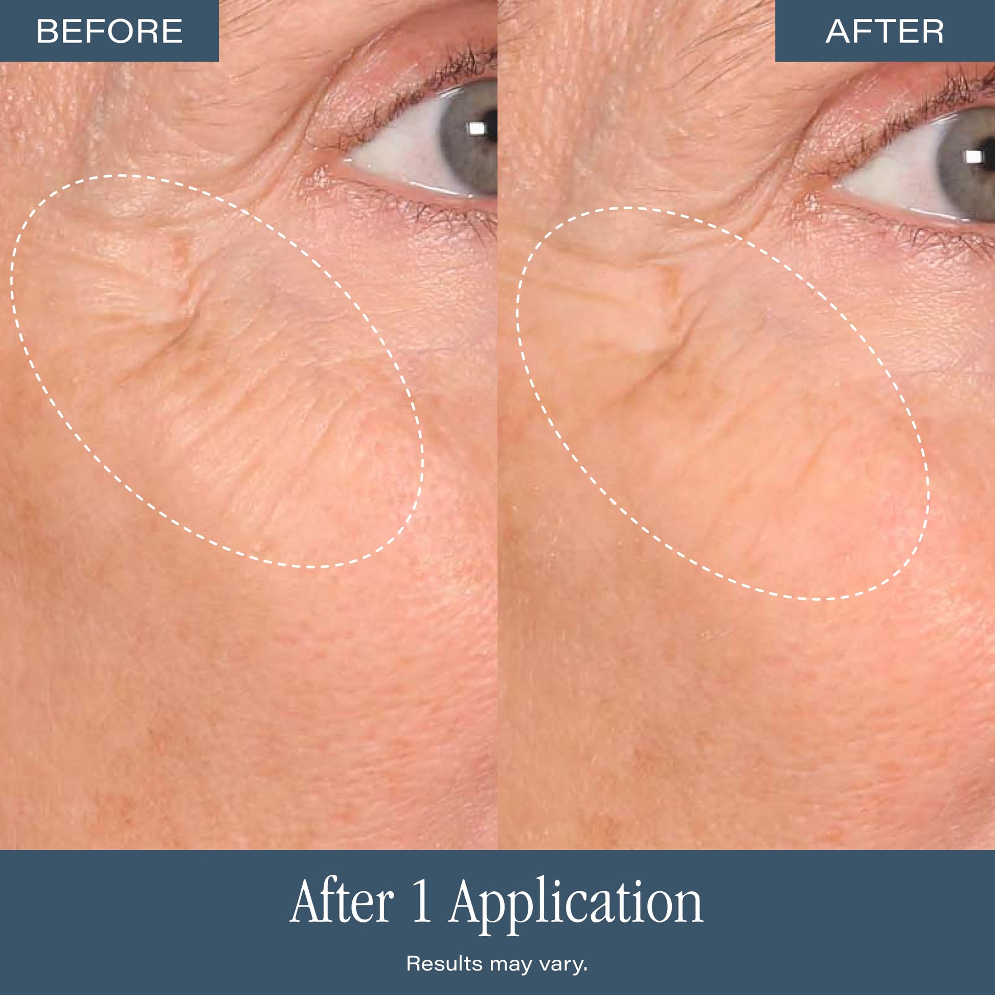 SKINN DermAppeal Microdermabrasion Facial Scrub luxury skincare tube imported by Rudra Retails