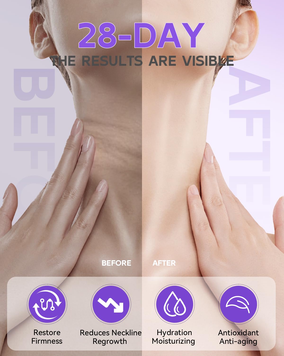 Loviton neck lifting and wrinkle reduction cream with cap off