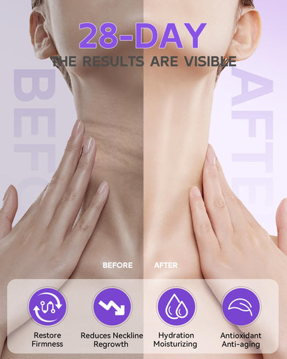 Loviton neck lifting and wrinkle reduction cream with cap off